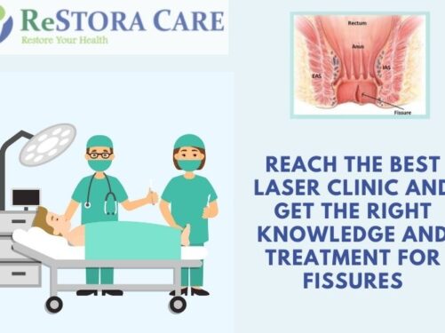 Fissure Surgery by Laser