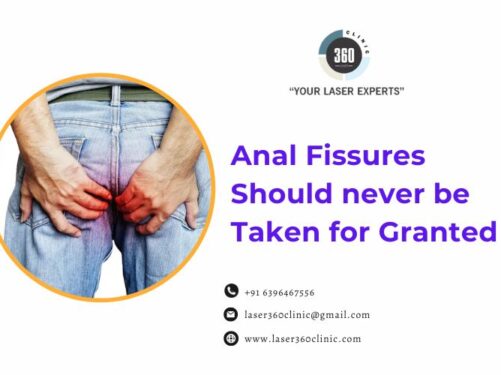 laser fistula surgery cost