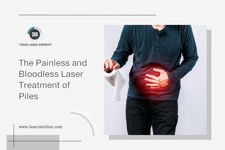 piles laser treatment cost