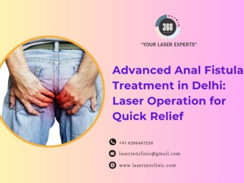 Anal Fistula Operation in Delhi
