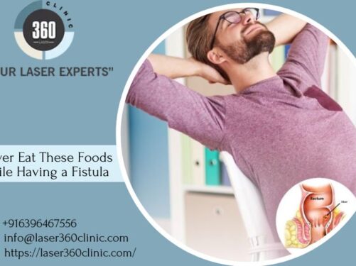 Laser treatment center near me