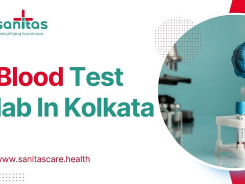 4 Things To Follow When Finding The Best Blood Test lab In Kolkata