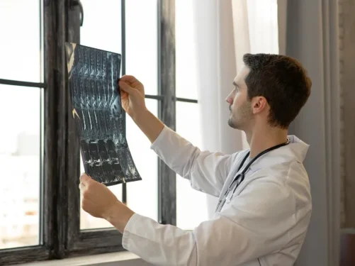 The Advantages of Choosing Digital X-Ray