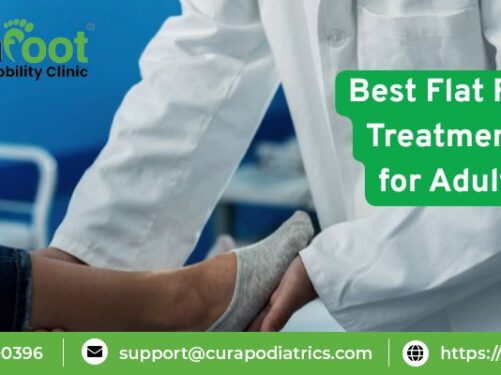 best treatment of flat foot