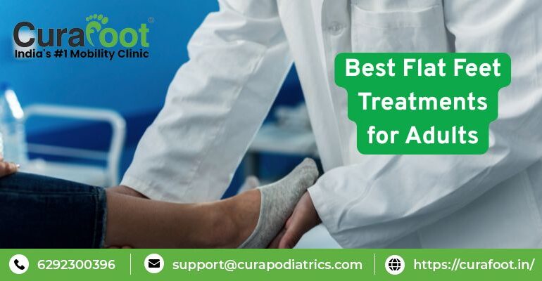 best treatment of flat foot