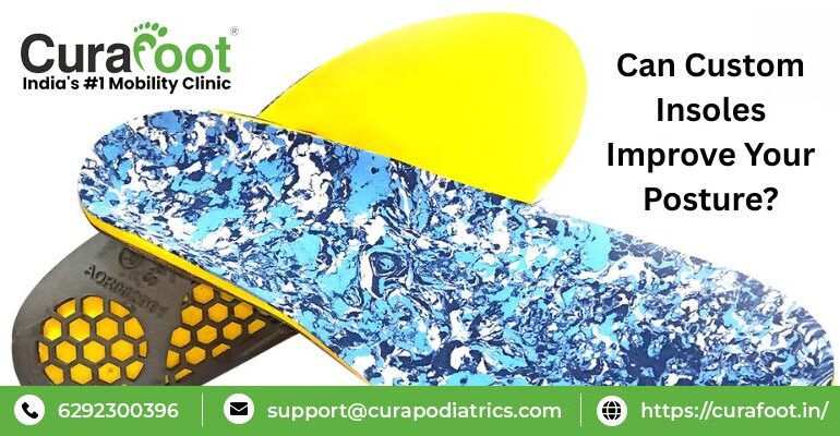 custom insoles