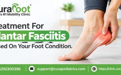 Treatment For Plantar Fasciitis