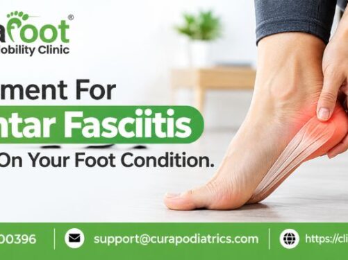 Treatment For Plantar Fasciitis