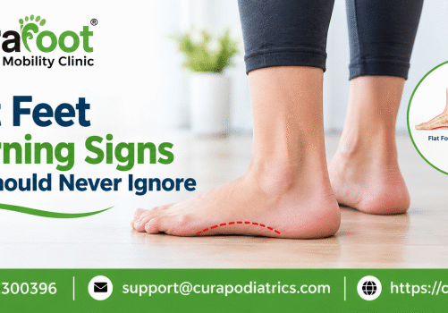 flat feet doctor in Kolkata