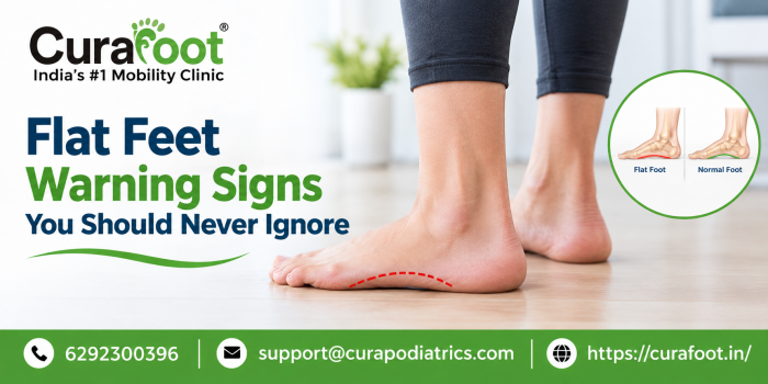 flat feet doctor in Kolkata