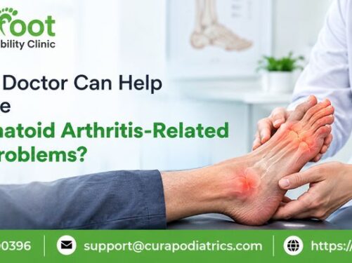 Rheumatoid Arthritis Doctor Kolkata