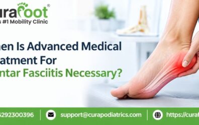 Treatment for Plantar Fasciitis