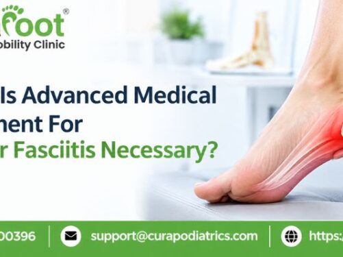 Treatment for Plantar Fasciitis